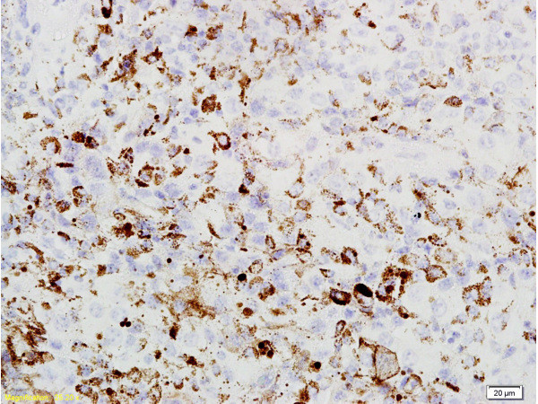 PRAME Antibody in Immunohistochemistry (Paraffin) (IHC (P))