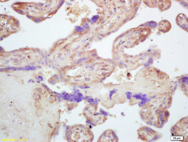 CARD4 Antibody in Immunohistochemistry (Paraffin) (IHC (P))