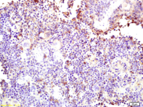 CARD4 Antibody in Immunohistochemistry (Paraffin) (IHC (P))