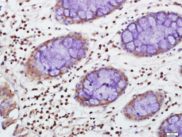 TIA1 Antibody in Immunohistochemistry (Paraffin) (IHC (P))