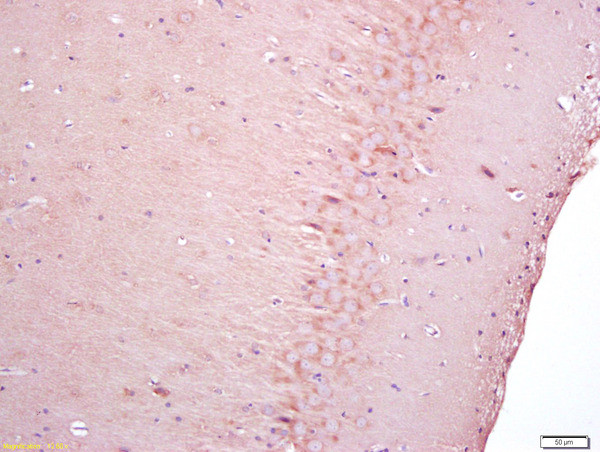 NGFR Antibody in Immunohistochemistry (Paraffin) (IHC (P))