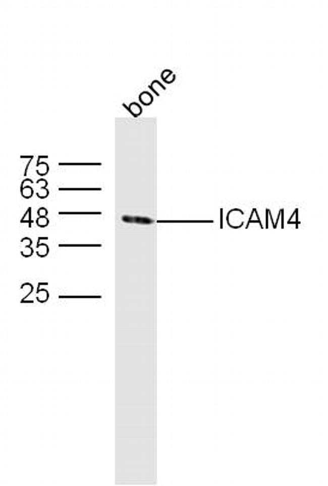 ICAM4 Antibody in Western Blot (WB)