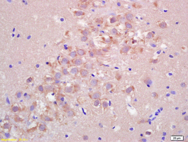 FIS1 Antibody in Immunohistochemistry (Paraffin) (IHC (P))