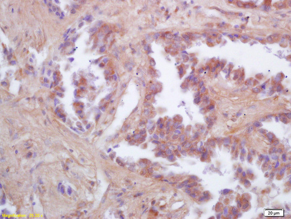 FIS1 Antibody in Immunohistochemistry (Paraffin) (IHC (P))