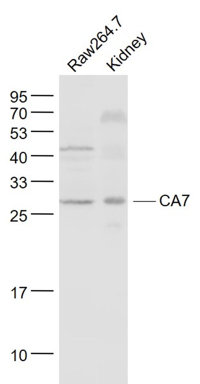 CA7 Antibody in Western Blot (WB)