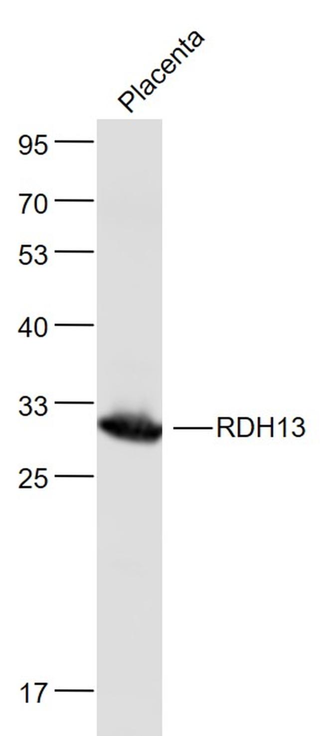 RDH13 Antibody in Western Blot (WB)