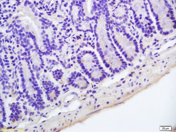 Hairless Antibody in Immunohistochemistry (Paraffin) (IHC (P))