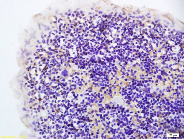 Hairless Antibody in Immunohistochemistry (Paraffin) (IHC (P))