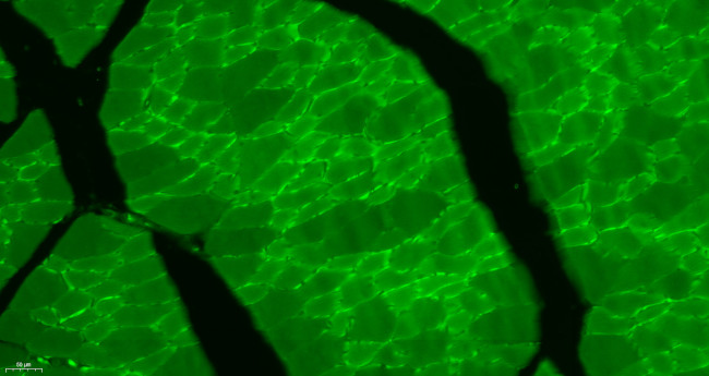 Desmuslin Antibody in Immunohistochemistry (Paraffin) (IHC (P))