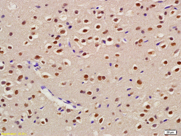 USP22 Antibody in Immunohistochemistry (Paraffin) (IHC (P))