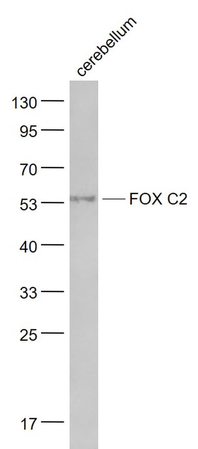 FOX C2 Antibody in Western Blot (WB)