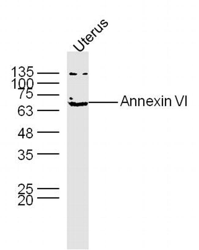 Annexin VI Antibody in Western Blot (WB)