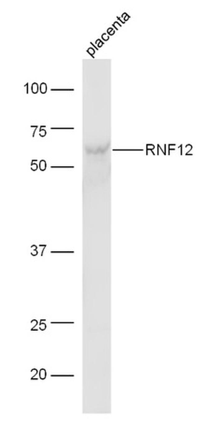 RNF12 Antibody in Western Blot (WB)