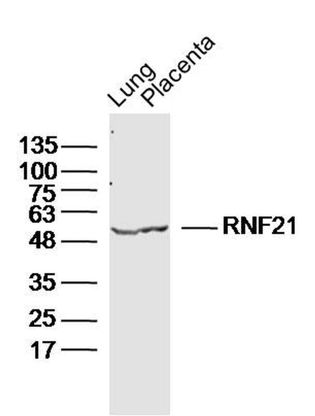 RNF21 Antibody in Western Blot (WB)