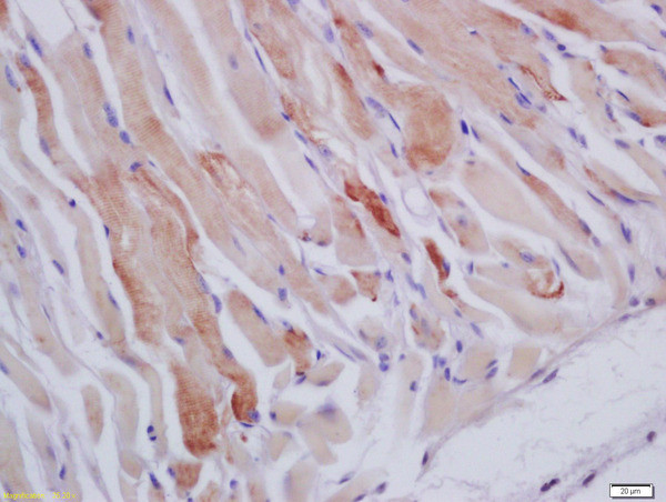 HSPB7 Antibody in Immunohistochemistry (Paraffin) (IHC (P))