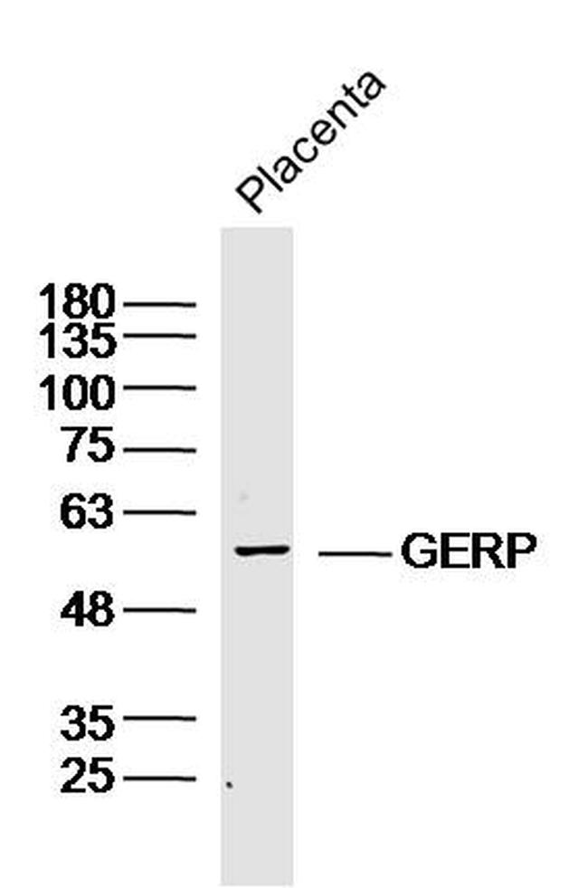 RNF27 Antibody in Western Blot (WB)