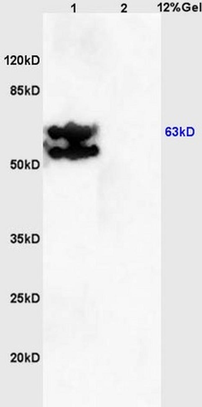 AMPK gamma 1/2/3 Antibody in Western Blot (WB)