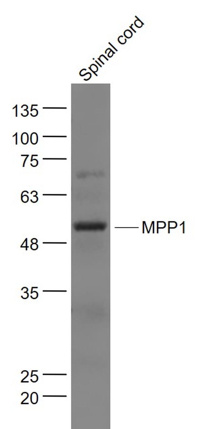 MPP1 Antibody in Western Blot (WB)