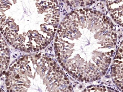 SHARPIN Antibody in Immunohistochemistry (Paraffin) (IHC (P))