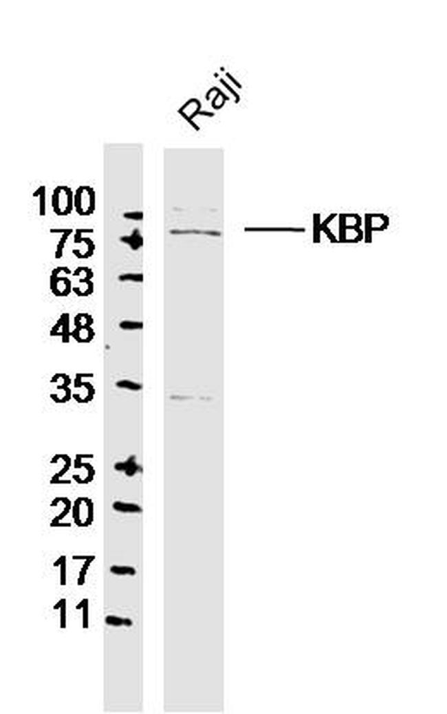 KBP Antibody in Western Blot (WB)