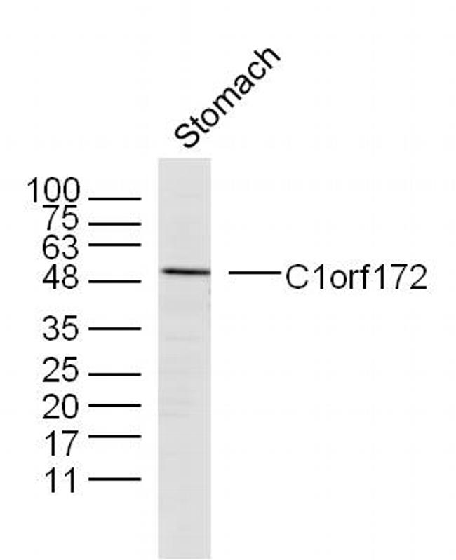 C1orf172 Antibody in Western Blot (WB)