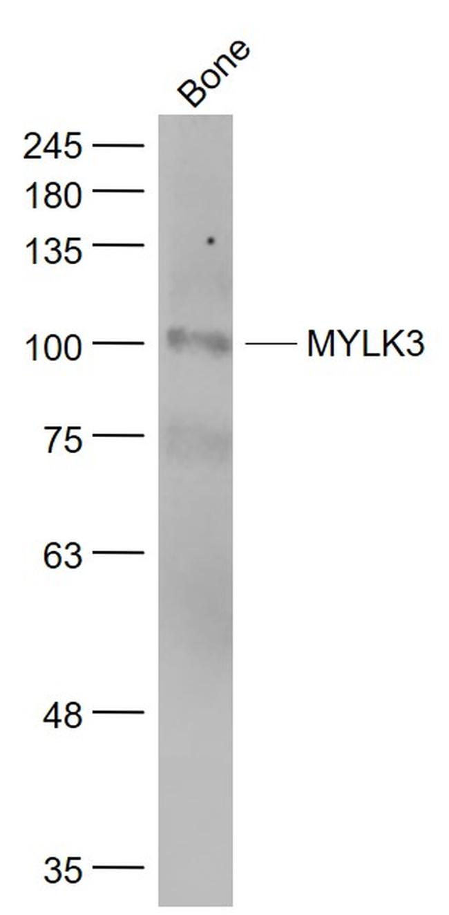 MYLK3 Antibody in Western Blot (WB)
