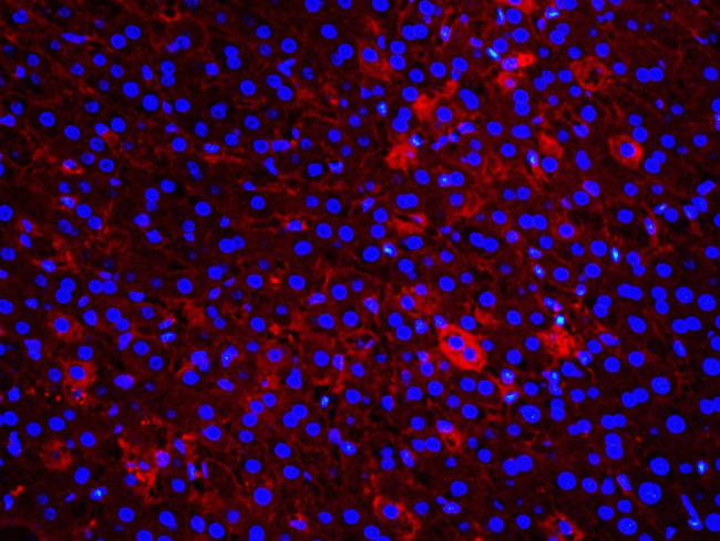 AFP Antibody in Immunohistochemistry (Paraffin) (IHC (P))