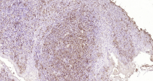 CD45 Antibody in Immunohistochemistry (Paraffin) (IHC (P))