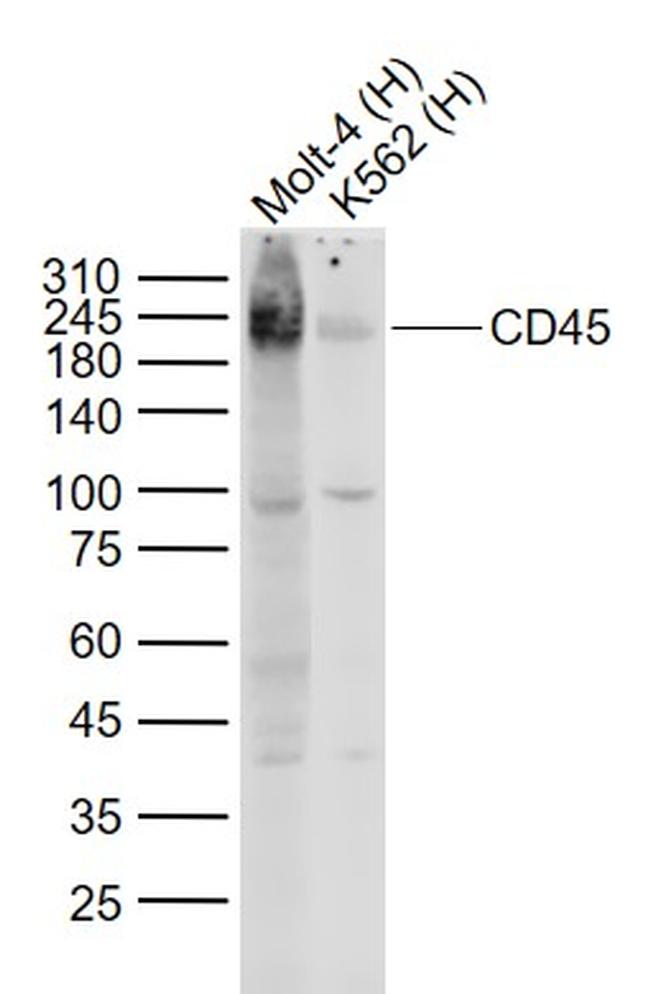 CD45 Antibody in Western Blot (WB)