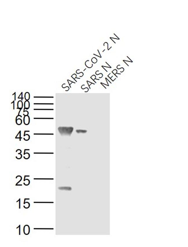 SARS Nucleocapsid Protein Antibody in Western Blot (WB)