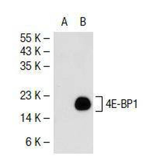 4E-BP1 Antibody in Western Blot (WB)