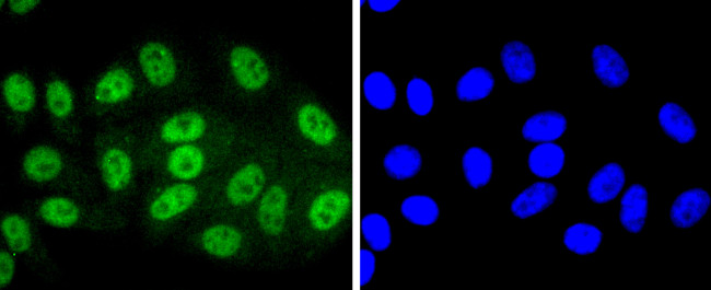 Phospho-SIRT1 (Thr530) Antibody in Immunocytochemistry (ICC/IF)