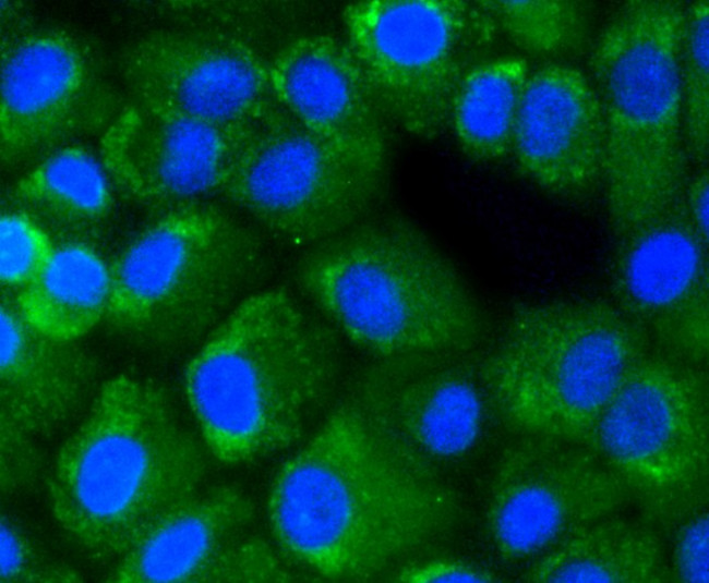 NF-kB p65 Antibody in Immunocytochemistry (ICC/IF)