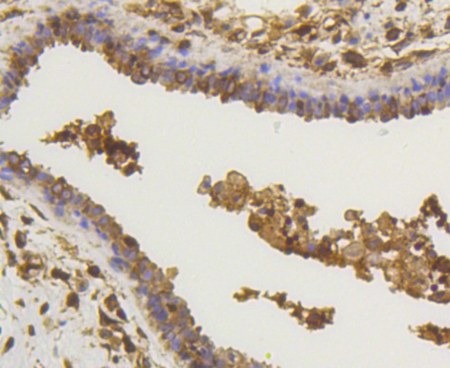 NF-kB p65 Antibody in Immunohistochemistry (Paraffin) (IHC (P))