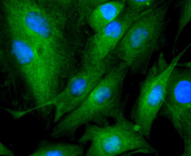 Tubulin beta-III Antibody in Immunocytochemistry (ICC/IF)