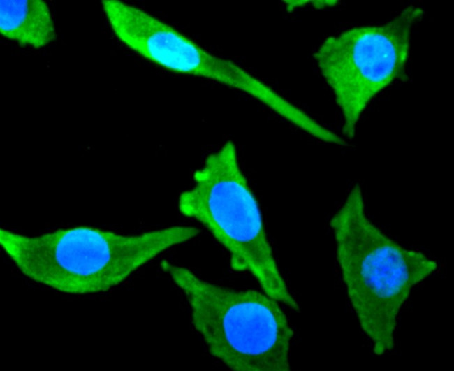 Tubulin beta-III Antibody in Immunocytochemistry (ICC/IF)