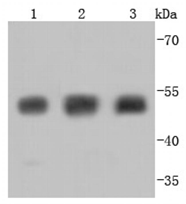 Tubulin beta-III Antibody in Western Blot (WB)