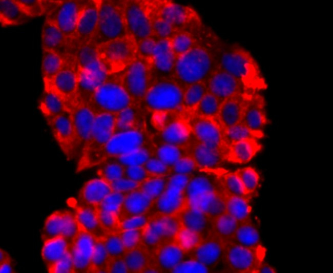 Synaptophysin Antibody in Immunocytochemistry (ICC/IF)