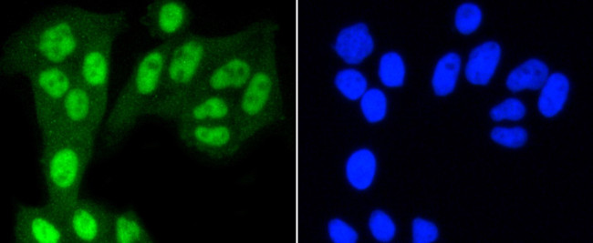 YAP1 Antibody in Immunocytochemistry (ICC/IF)