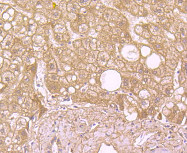 SOD2 Antibody in Immunohistochemistry (Paraffin) (IHC (P))