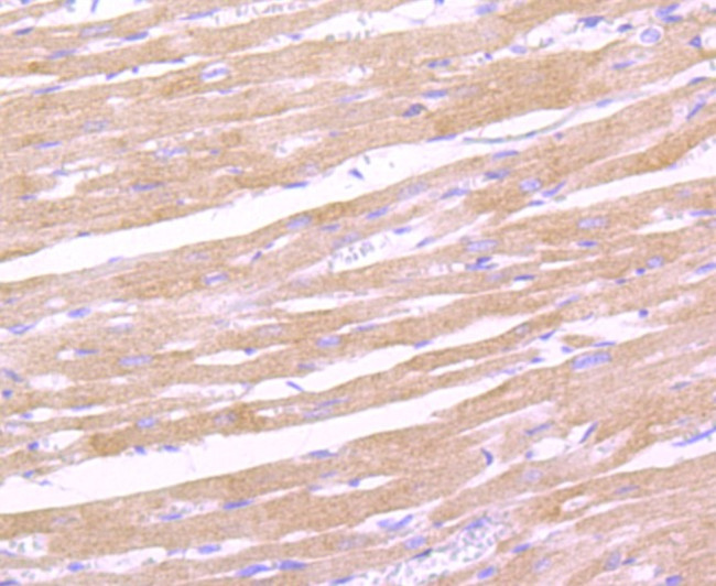 CD163 Antibody in Immunohistochemistry (Paraffin) (IHC (P))