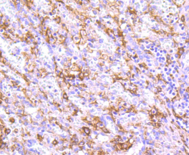 CD163 Antibody in Immunohistochemistry (Paraffin) (IHC (P))