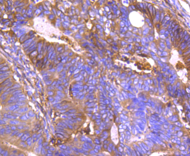 Annexin A2 Antibody in Immunohistochemistry (Paraffin) (IHC (P))