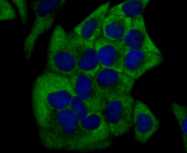 Cytochrome P450 17A1 Antibody in Immunocytochemistry (ICC/IF)