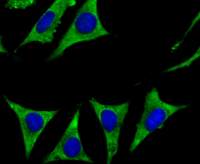 Cytochrome P450 17A1 Antibody in Immunocytochemistry (ICC/IF)