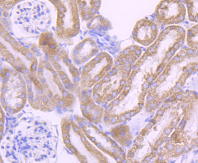 Cytochrome P450 17A1 Antibody in Immunohistochemistry (Paraffin) (IHC (P))