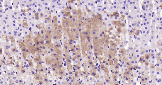 Cytochrome P450 17A1 Antibody in Immunohistochemistry (Paraffin) (IHC (P))