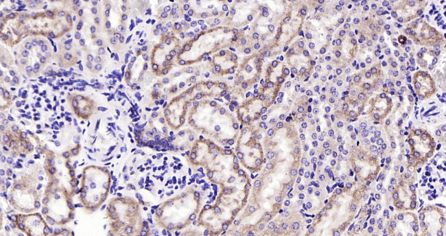 Cytochrome P450 17A1 Antibody in Immunohistochemistry (Paraffin) (IHC (P))