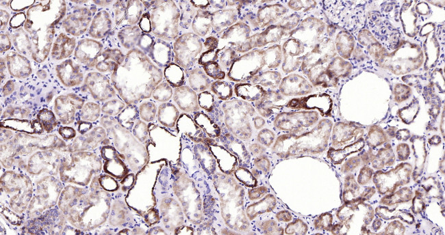 Cytochrome P450 17A1 Antibody in Immunohistochemistry (Paraffin) (IHC (P))