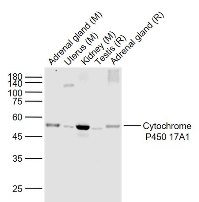 Cytochrome P450 17A1 Antibody in Western Blot (WB)